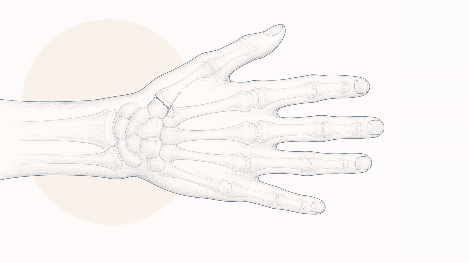 Fractures and dislocations