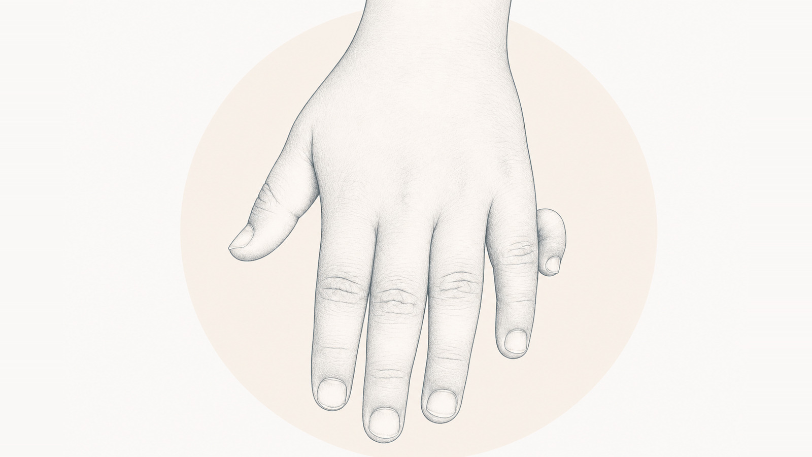 Polydactyly